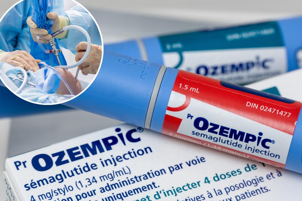 Ozempic cuts knee osteoarthritis pain by almost half: 'That's huge'